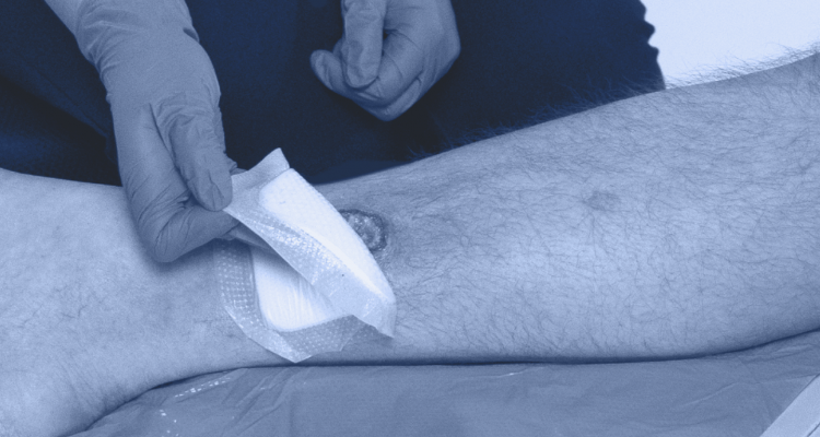 Clinician bandaging a patient's wound